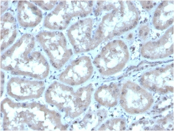CA9 Antibody / Carbonic Anhydrase IX