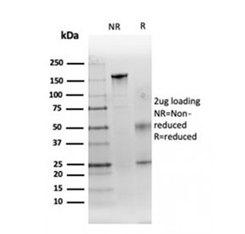 CA9 Antibody / Carbonic Anhydrase IX