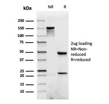 Recombinant Catenin beta Antibody