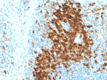Recombinant CD14 Antibody