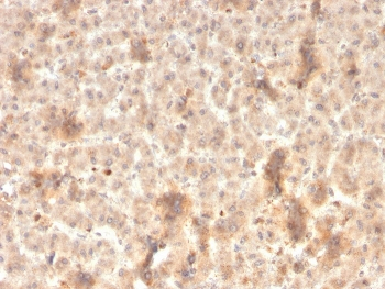 Recombinant Secretory Component Antibody / ECM1