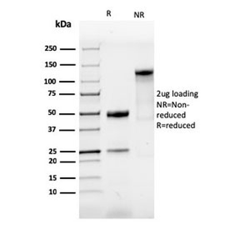 Recombinant SOX9 Antibody
