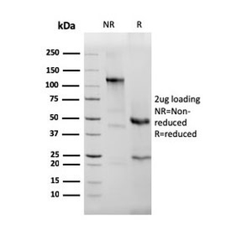 Recombinant Eosinophil Peroxidase Antibody