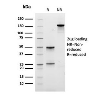 Recombinant EPX Antibody / Eosinophil Peroxidase