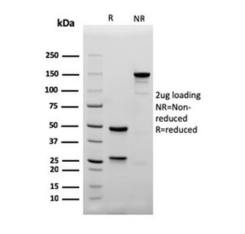Recombinant CD4 Antibody