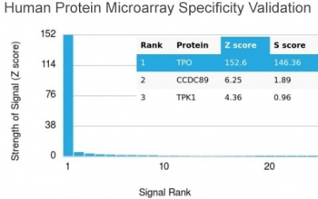 Thyroid Peroxidase Antibody / TPO
