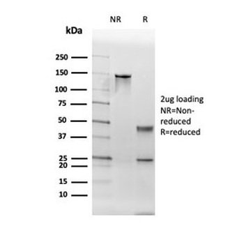 Thyroid Peroxidase Antibody / TPO