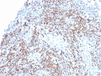 Recombinant ZAP70 Antibody