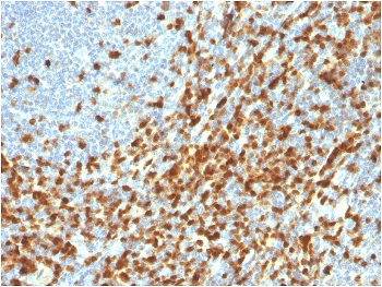 Recombinant ZAP70 Antibody