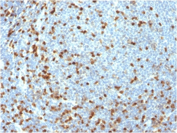 Recombinant ZAP70 Antibody