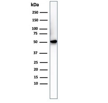 Histidine Antibody / His Tag