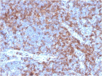 Recombinant CD22 Antibody / BL-CAM
