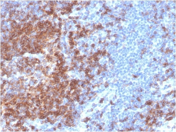 Recombinant CD22 Antibody / BL-CAM