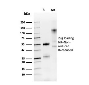 Recombinant PAX8 Antibody