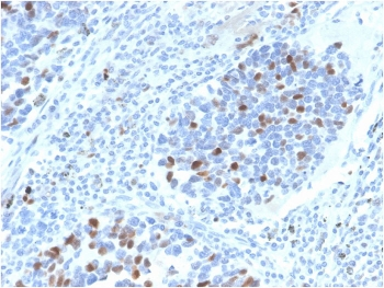 Recombinant p21 Antibody