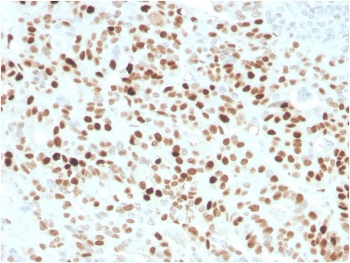 Recombinant p21 Antibody