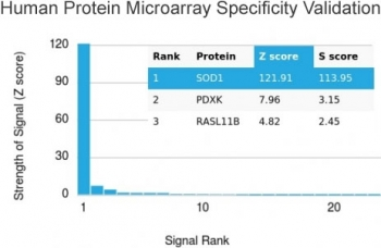 SOD1 Antibody / Superoxide Dismutase 1