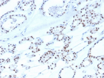 Recombinant PAX8 Antibody