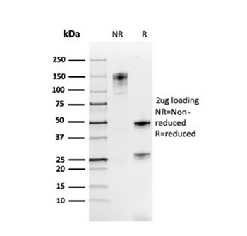 Recombinant PAX8 Antibody