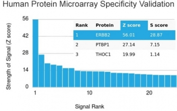 HER2 Antibody / ErbB2 / Extracellular region