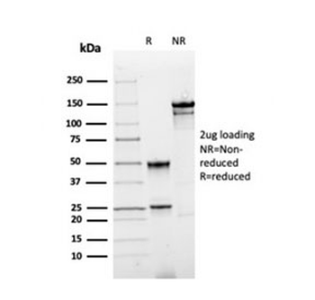Recombinant Annexin A1 Antibody