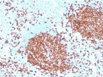Recombinant PAX5 Antibody