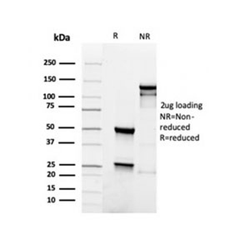 Recombinant PAX5 Antibody