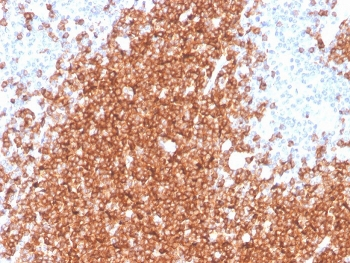 Recombinant CD22 Antibody / BL-CAM