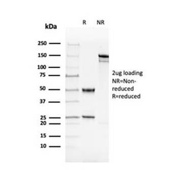 Recombinant dsDNA Antibody