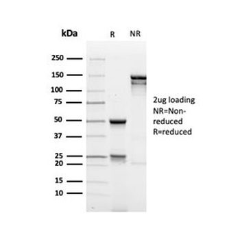 Recombinant MUC1 Antibody / Mucin-1