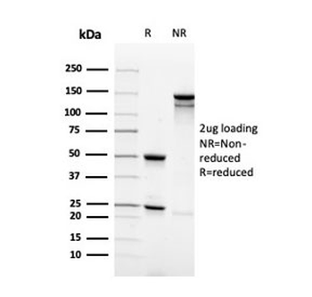Recombinant Synaptophysin Antibody