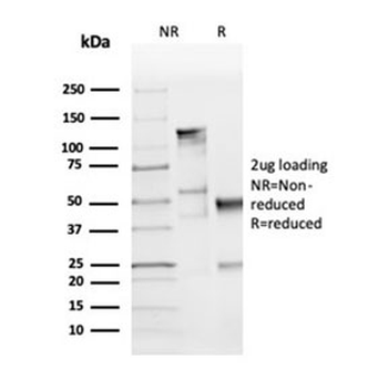 Recombinant Cyclin D1 Antibody