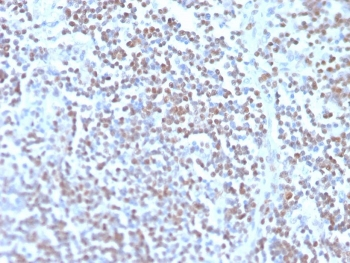 Recombinant Cyclin D1 Antibody
