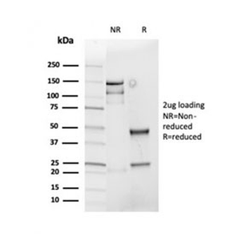 Recombinant Cyclin D1 Antibody