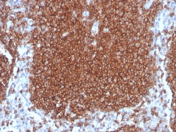 Recombinant CD19 Antibody