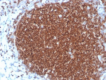 Recombinant CD19 Antibody