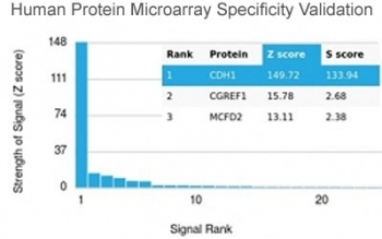 Recombinant E-Cadherin Antibody / CDH1