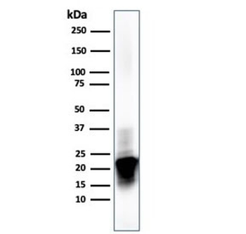 Myelin Basic Protein Antibody