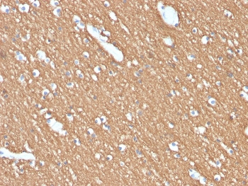 Myelin Basic Protein Antibody
