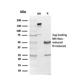 Myelin Basic Protein Antibody