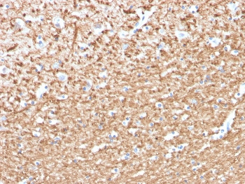 Myelin Basic Protein Antibody