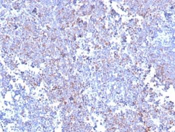 Recombinant SOX11 Antibody