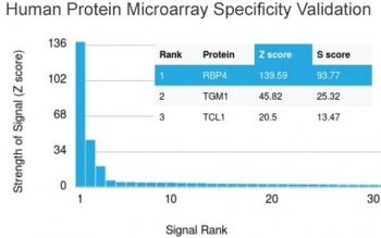 RBP4 Antibody / Retinol Binding Protein 4