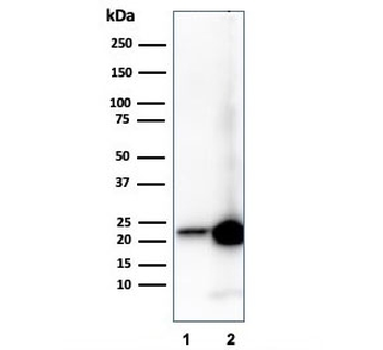 RBP4 Antibody / Retinol Binding Protein 4