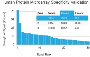 RBP4 Antibody / Retinol Binding Protein 4