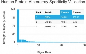 RBP4 Antibody / Retinol Binding Protein 4