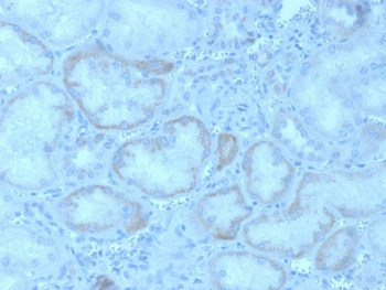 FGF23 Antibody / Fibroblast Growth Factor 23