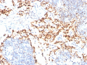 TIM-3 Antibody / HAVCR2