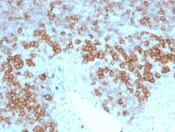 CD27 Antibody