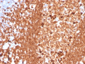 Recombinant CD79a Antibody